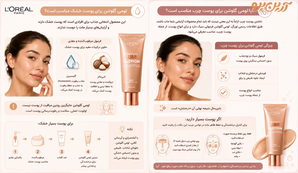لومی گلشون